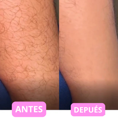 Depiladora de Crystal Blyssa