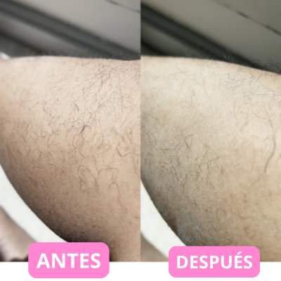 Depiladora de Crystal Blyssa