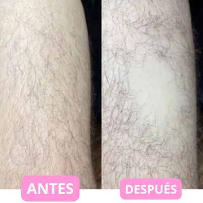 Depiladora de Crystal Blyssa