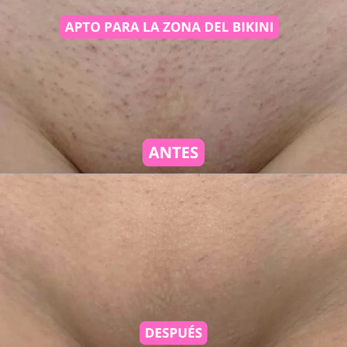 Depiladora de Crystal Blyssa